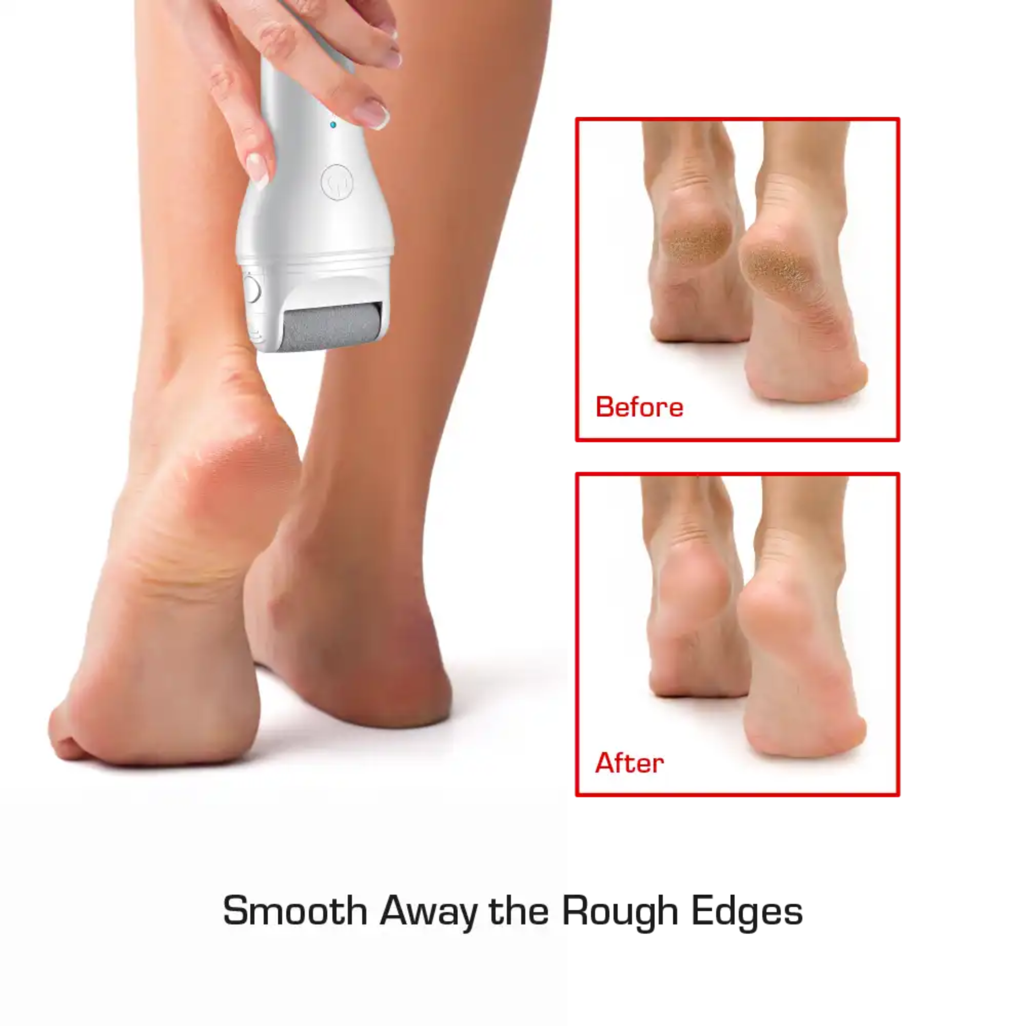 RED BY KISS CORDLESS FOOT CALLUS REMOVER | FCR01
