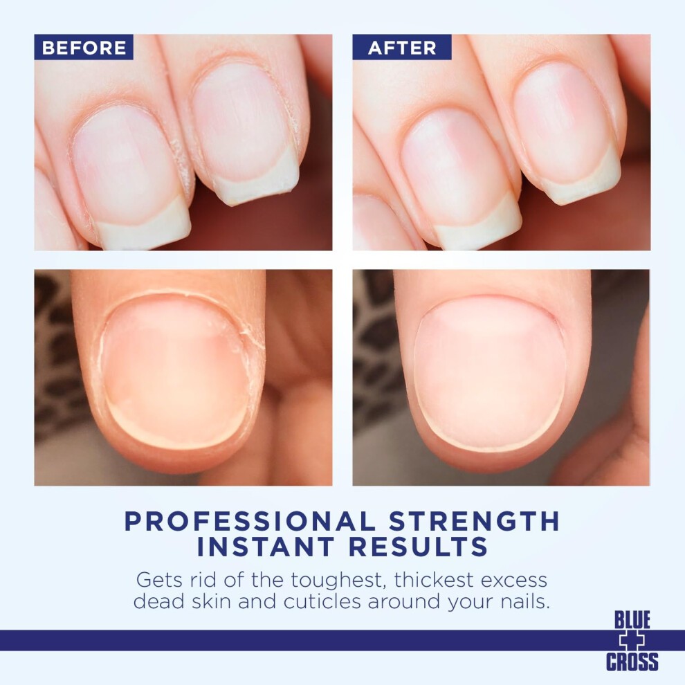 BLUE CROSS CUTICLE REMOVER LANOLIN ENRICHED