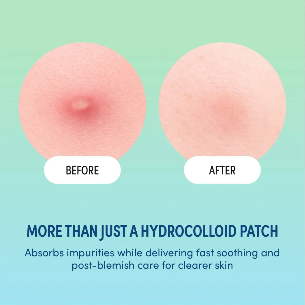 KISS HAPPY SKIN COLORFUL SPOT PATCH | KAP02