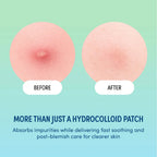 KISS HAPPY SKIN COLORFUL SPOT PATCH | KAP02